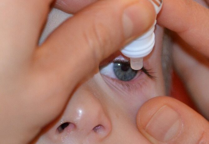 Yeux secs en Provence : chaleur, mistral, climatisation… pourquoi nos yeux souffrent-ils davantage en été ? »